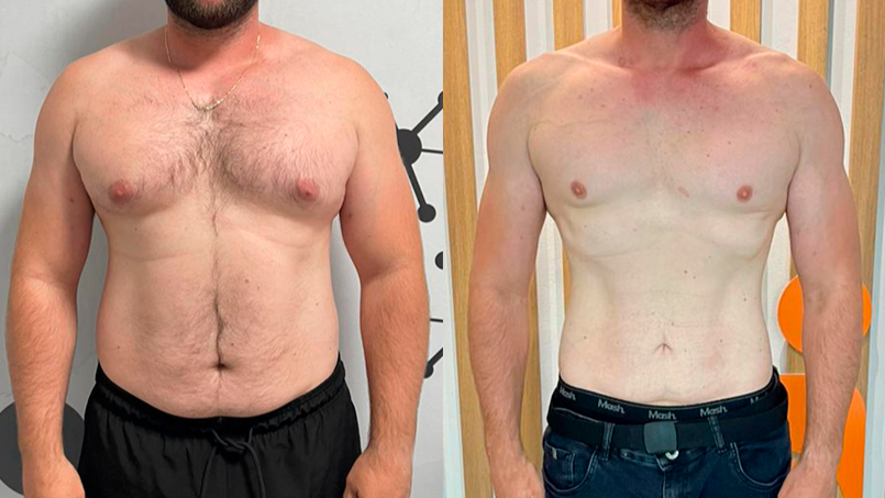 antes-e-depois